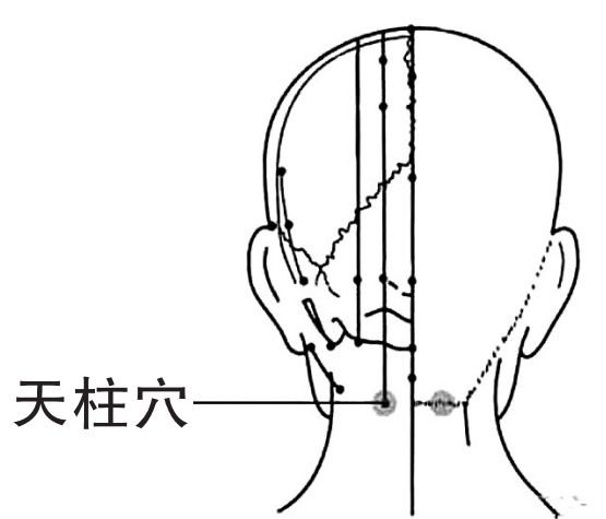 按揉天柱穴可缓解头痛