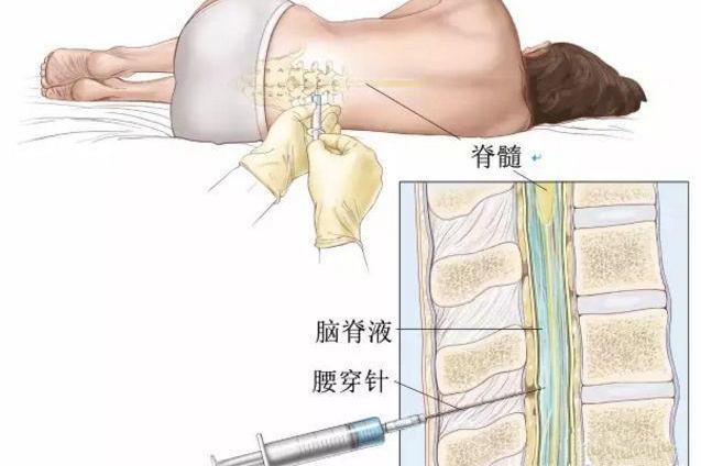 四大穿刺 直击病变内心