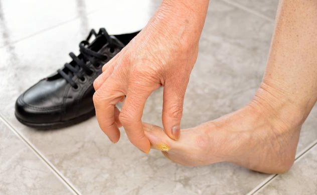 腿脚有问题 查查血脂