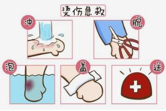 急救小能手：烫伤烧伤家庭护理全攻略