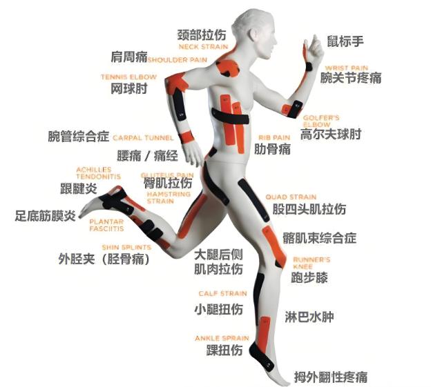运动损伤的中西医治疗策略