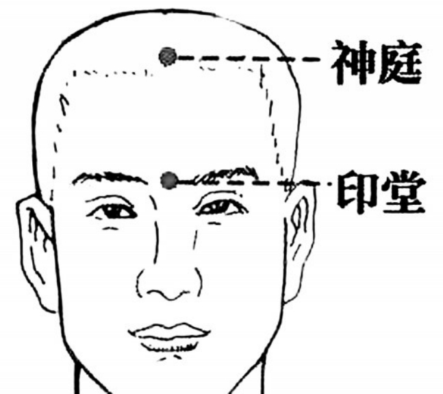 常失眠 按揉印堂、神庭穴