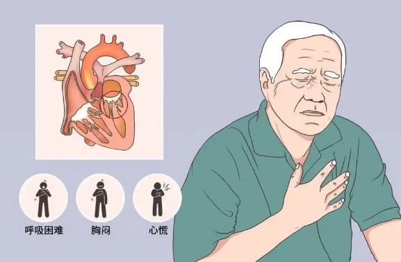 心力衰竭患者的日常护理,细节决定成败!