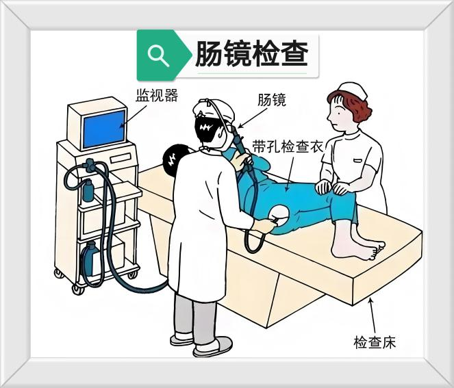 肠检查，常安心