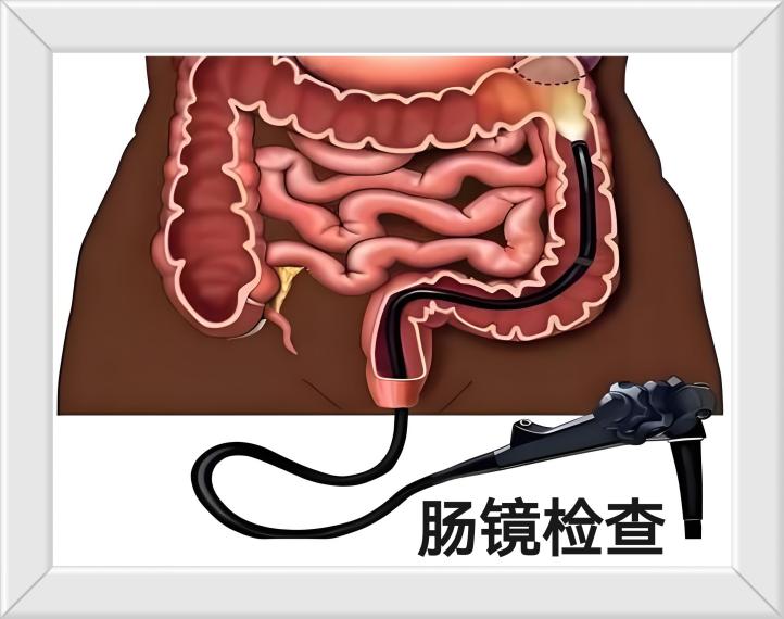 肠检查，常安心
