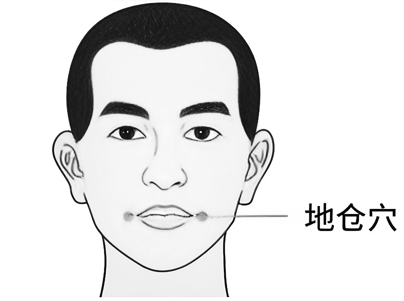 口歪、流涎 揉按地仓穴