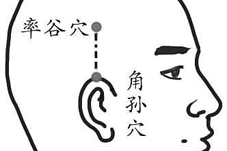 偏头痛按角孙、率谷