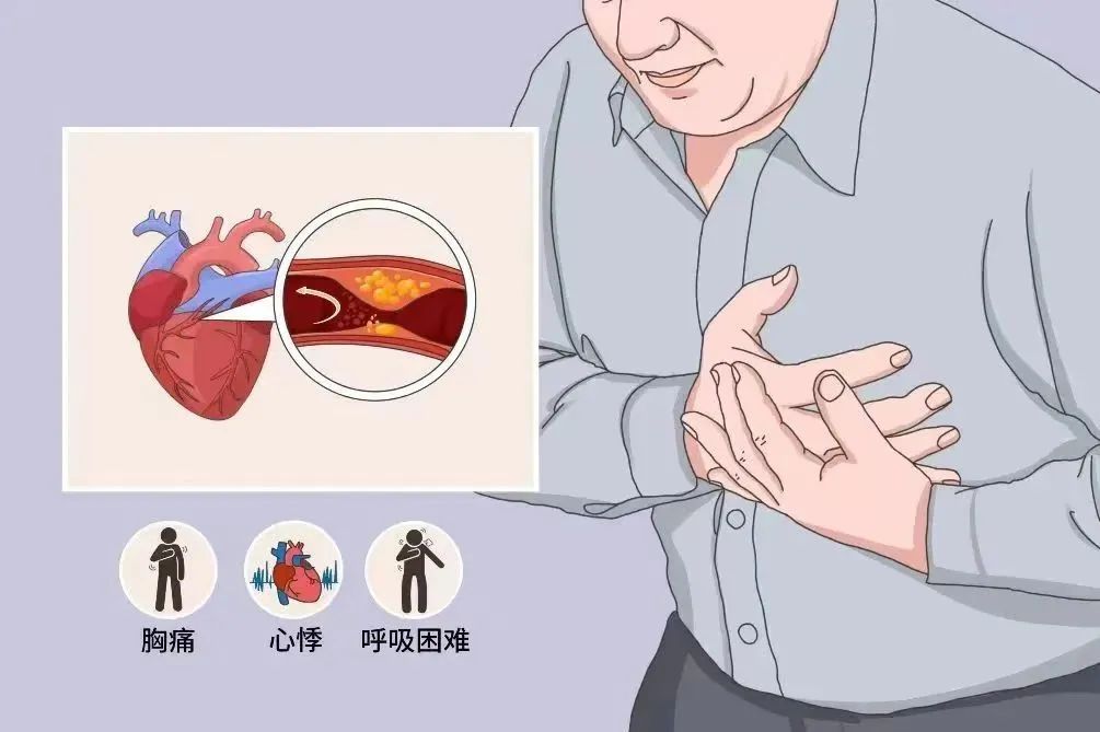 冠心病科普——幸福从“心”开始