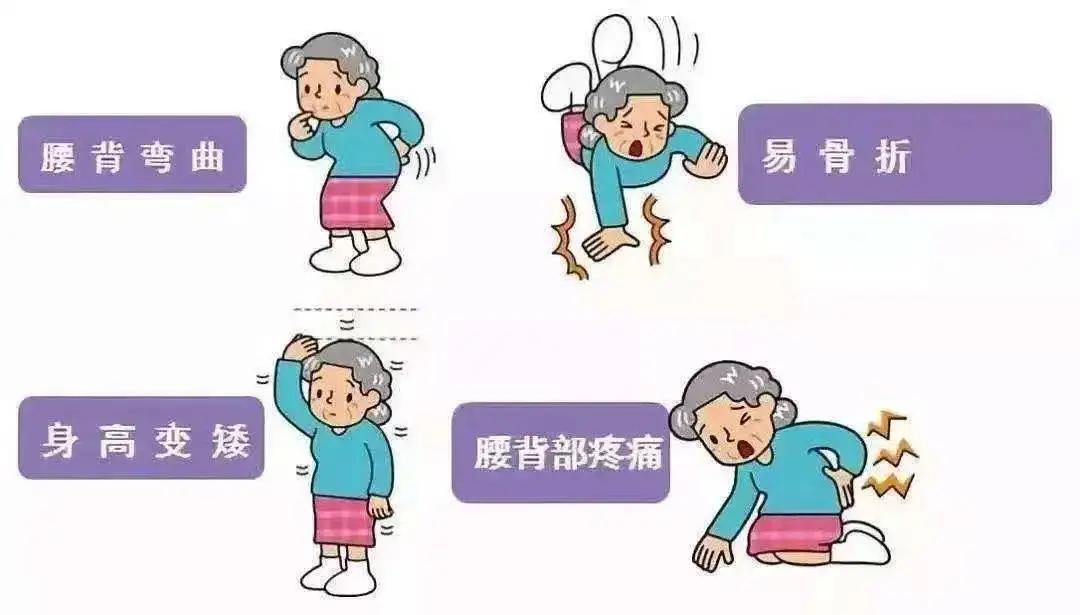 警惕身边的“沉默杀手”——骨质疏松症