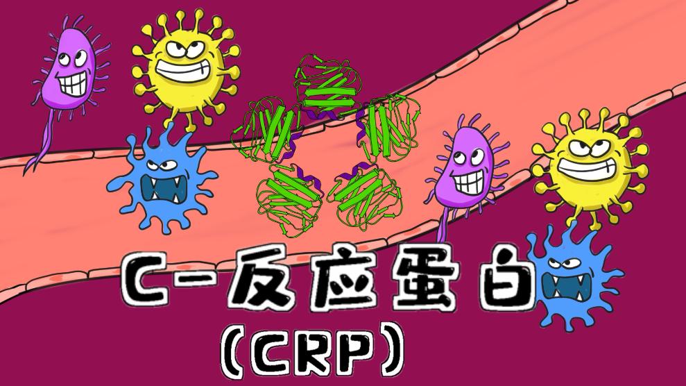 临床检验为何要做C反应蛋白？