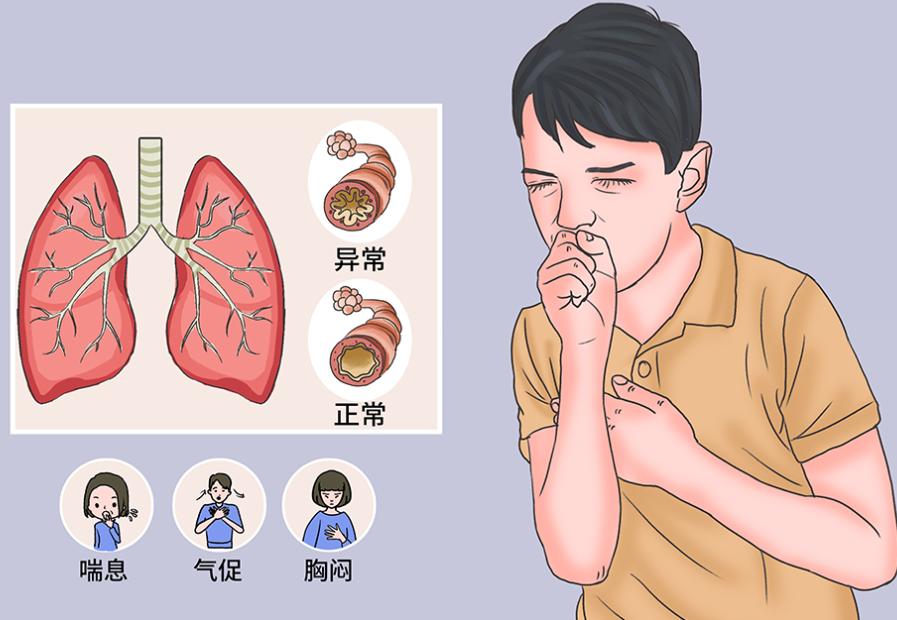 哮喘患者日常护理全攻略：从用药到生活细节