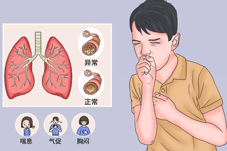 哮喘患者日常护理全攻略：从用药到生活细节