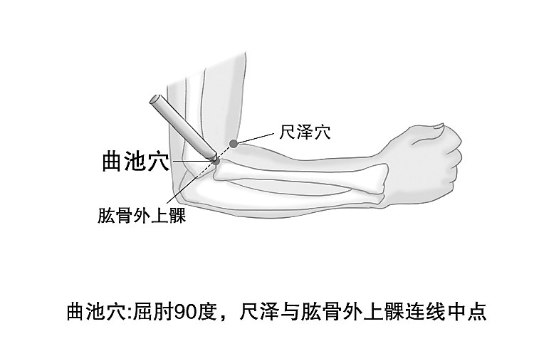 痒不停？中医来调