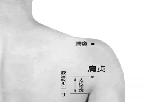 秋季高发五十肩 中医来防治