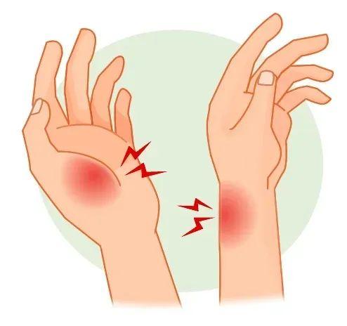 “妈妈手”“扳机指”都是腱鞘炎