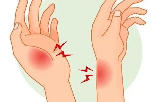 “妈妈手”“扳机指”都是腱鞘炎