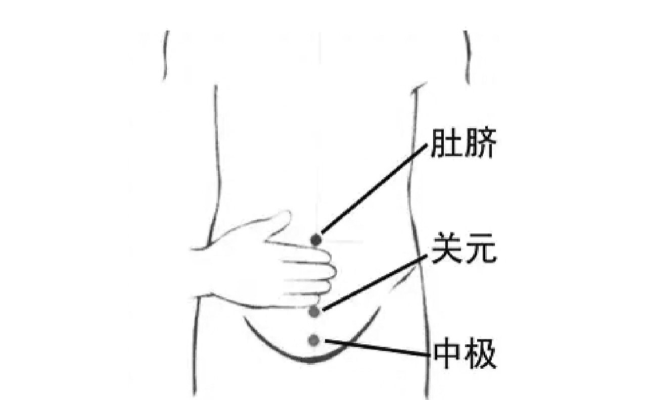 老年女性尿失禁中西医防治