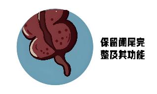 我的阑尾我做主——ERAT治疗术，守护肠道“小盲端”