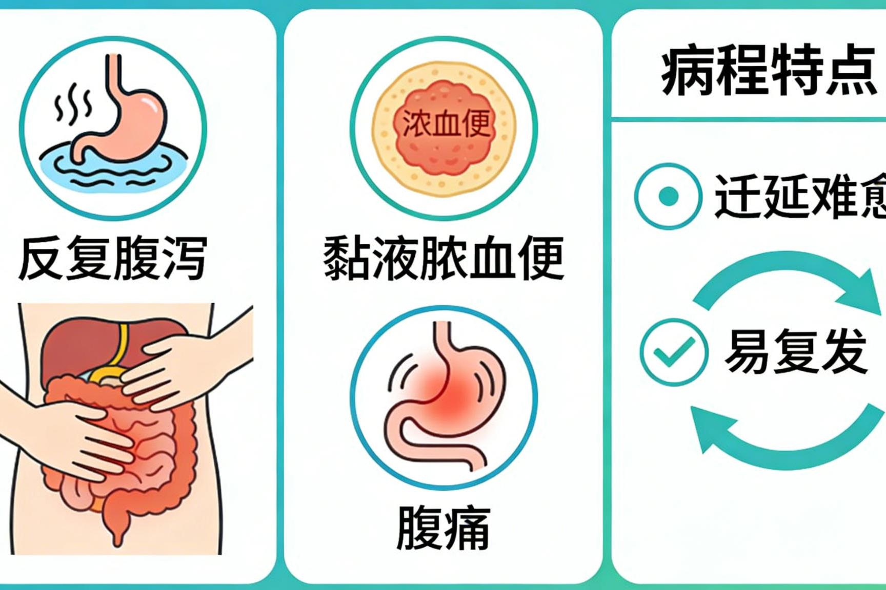 溃疡性结肠炎怎样治