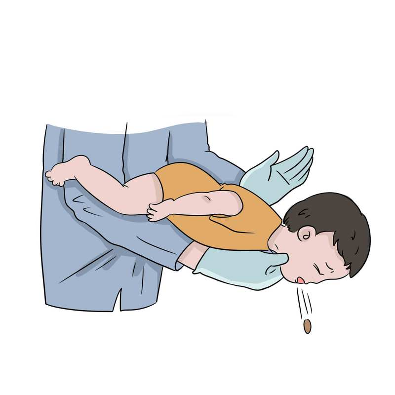 突发状况急救方法详解