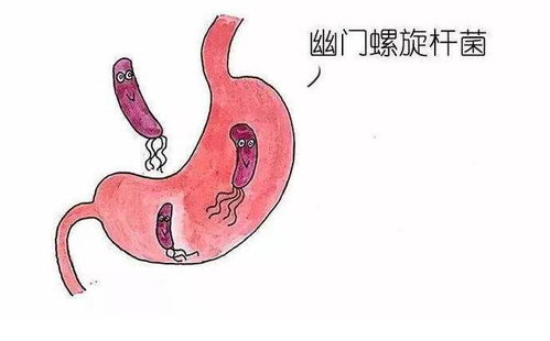 幽门螺杆菌阳性，到底要不要“杀”？治疗前必看的利弊权衡