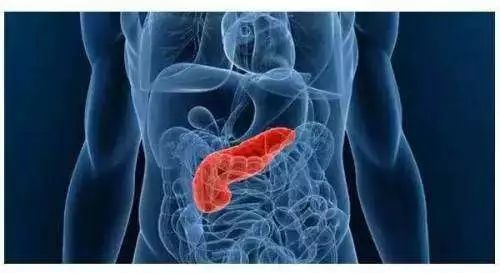 饱餐之后胃痛？警惕急性胰腺炎，别当成普通胃病