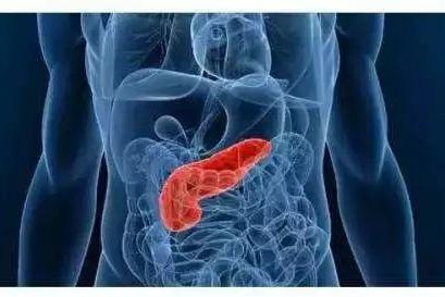 饱餐之后胃痛？警惕急性胰腺炎，别当成普通胃病